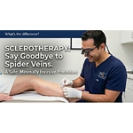 Say Goodbye to Spider Veins: Understanding Sclerotherapy
