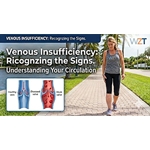 What is Venous Insufficiency? Recognizing the Signs